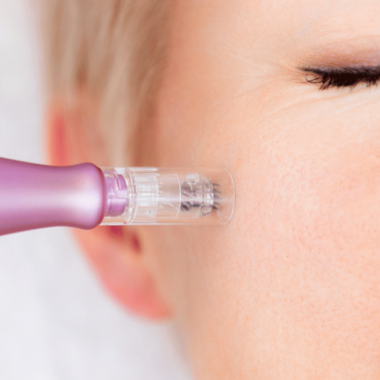 microneedling benefits
