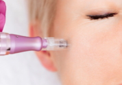 microneedling benefits